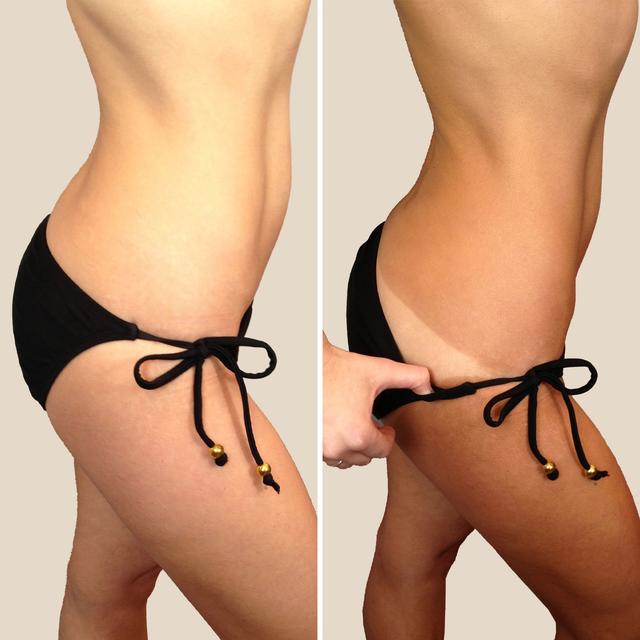 BRONZE-SET--SEKCIJA-2