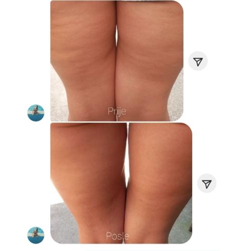 64a690d918e41fc9c8d9613f-1688637657728