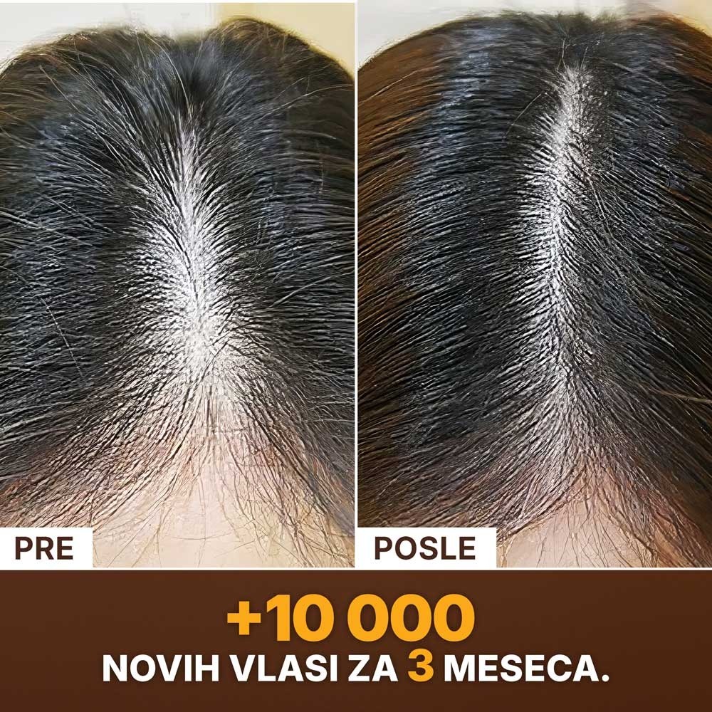 SLAJD-6----PRIJE-POSLIJE---SRB