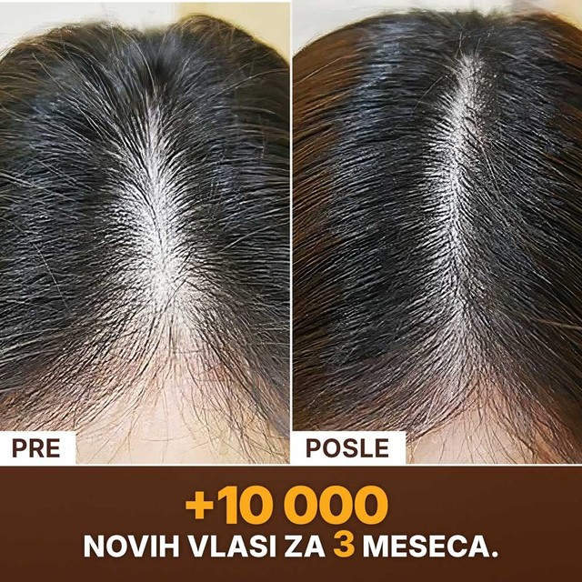 SLAJD-6----PRIJE-POSLIJE---SRB
