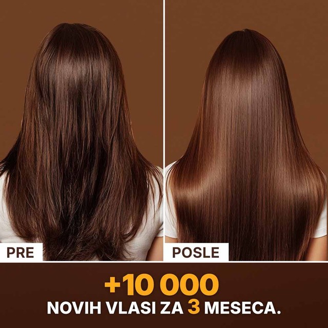 SLAJD-4----PRIJE-POSLIJE---SRB